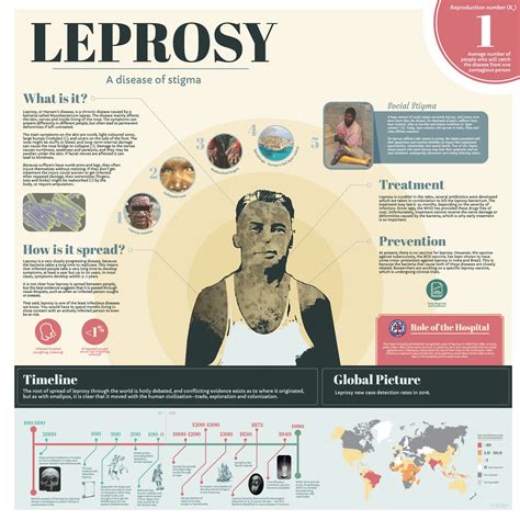 history of leprosy treatment