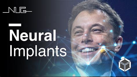 history of neural implants