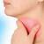 hiv symptom sore throat