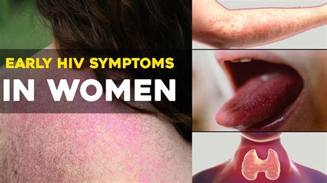 5 Common HIV Symptoms in Men Ladies, See How To Know If