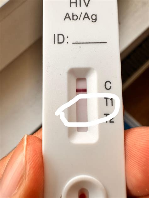 Hiv Test Kit Reddit