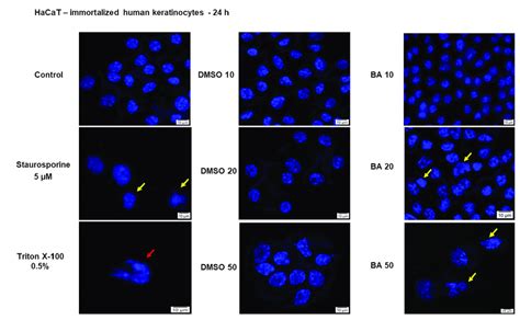 Hoechst Stain Solution