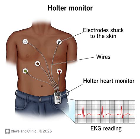 Holter Monitor False Readings