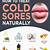 home remedies for cold sores on lip