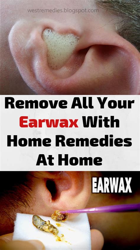 How Long To Remove Ear Wax HOWOTREMVO