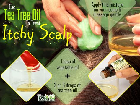 home remedy for baby itchy scalp