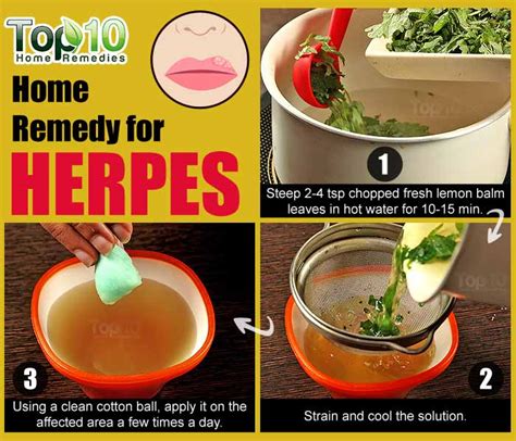 Home Remedies for Shingles (Herpes Zoster)
