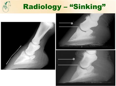 Horse Laminitis Sinker