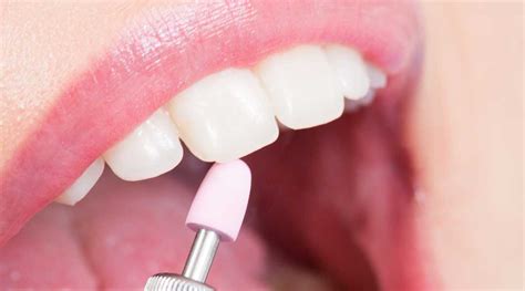 Dentistry. Dentist polishing kids teeth. Stock Video Footage 0019 SBV