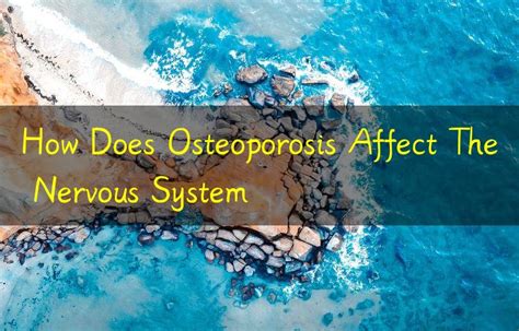 how does osteoporosis affect the nervous system