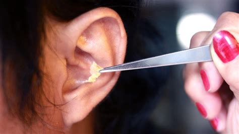 How To Clean Out Ear Wax Build Up