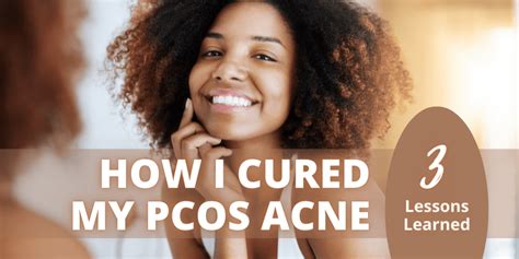 how i cured my pcos acne
