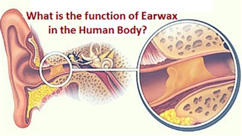 Your Earwax Can Tell How Healthy You Are. What Color Is Yours? Ear