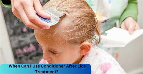 How to Get Rid of Lice Fast10 Best Home Remedies Home lice remedies