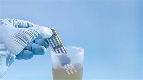 Alcohol Drug Test Panels ETG Alcohol Urine & Hair Testing