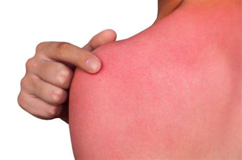 Chlorine Rash Pictures, Causes and Treatments