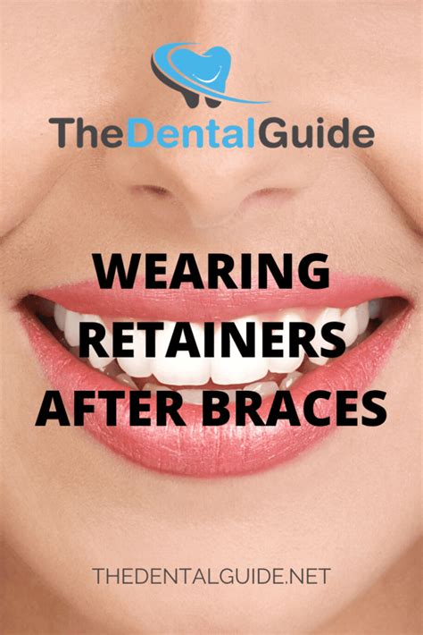 How Long Does It Take To Remove Top Braces Thinkervine