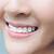 how long does retainer pain last