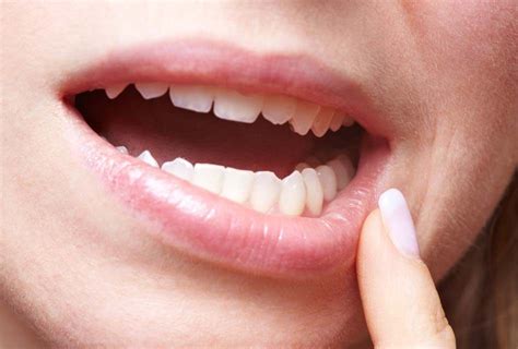 How Long Will My Mouth Be Numb? Robinson's Dental Practice
