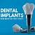 how much are affordable dental implants