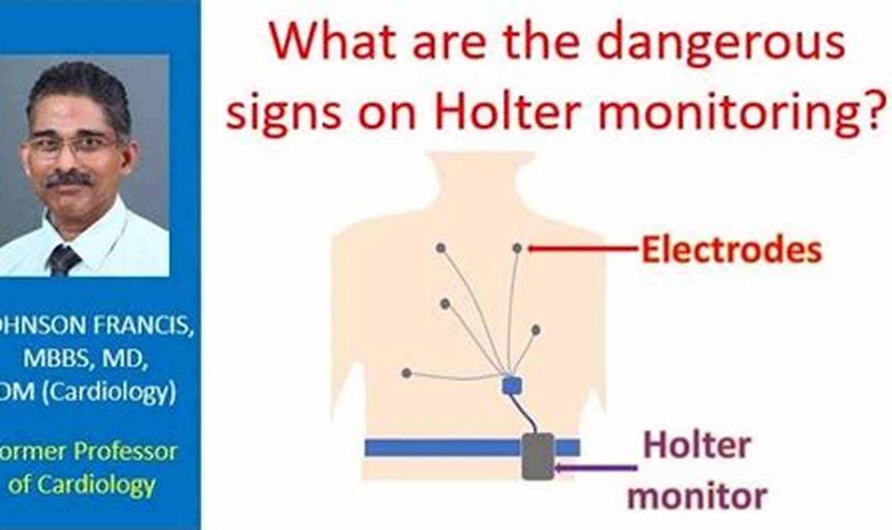 How Much Does A Holter Monitor Cost Without Insurance?