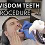 how much is it to remove wisdom teeth in ontario