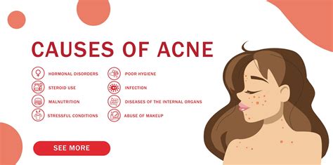 how to balance hormones for acne