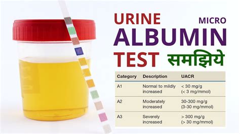 Is Albumin in urine ayurvedic treatment effective?