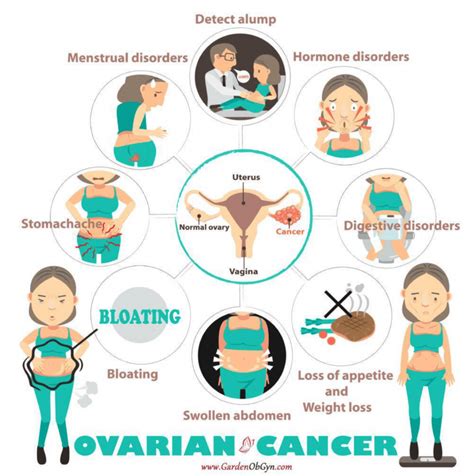 Ovarian Cancer Awareness Medivizor