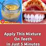 how to clean plaque off teeth with braces