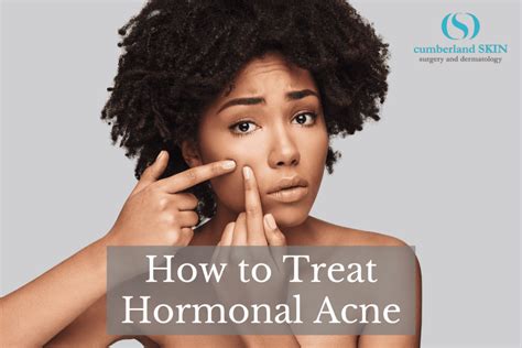 how to combat hormonal acne