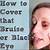 how to cover up a black eye without makeup
