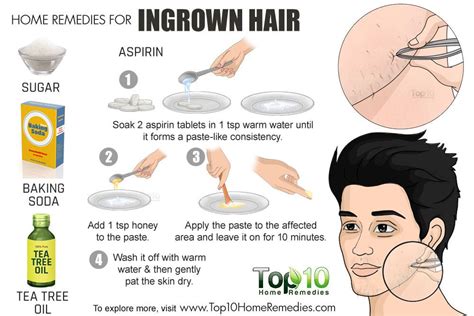 How To Cure Ingrown Hair On Neck