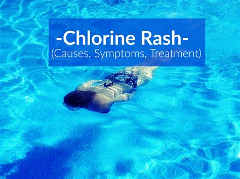Chlorine Rash Symptoms, Treatment, Prevention