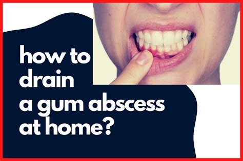 How To Drain A Gum Abscess At Home?