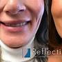 how to fix a crooked smile with botox