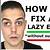 how to fix lazy eye