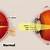 how to fix long sightedness