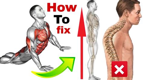 how to fix lower back arch