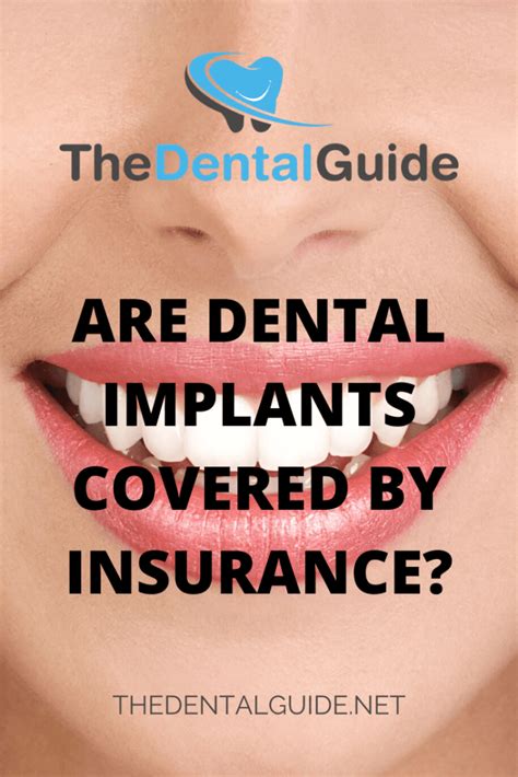 How to get dental implants covered by insurance Quora