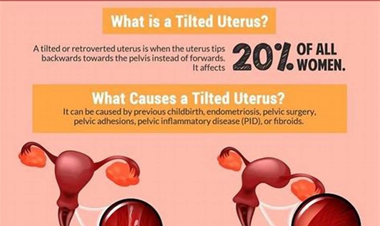 Get Pregnant with a Retroverted Uterus: Tips and Strategies for Success
