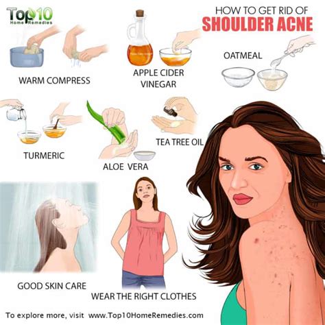 how to get rid of acne on arms and shoulders