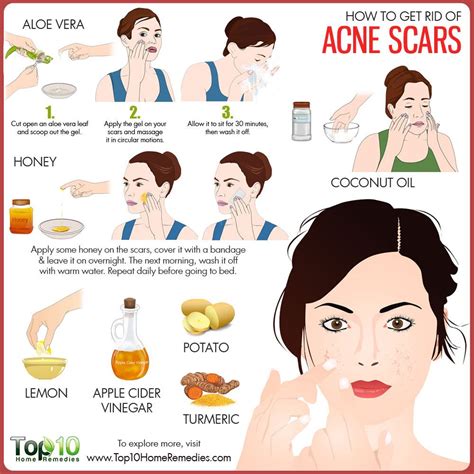 how to get rid of acne scars overnight