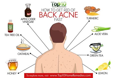 how to get rid of back acne naturally