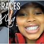 how to get rid of bottom braces pain