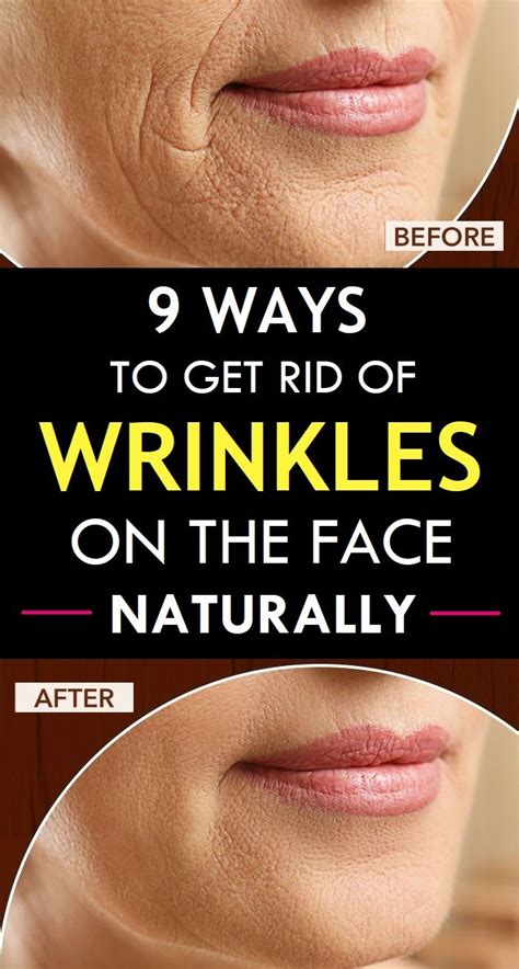 How To Get Rid Of Chin Lines: Tips And Tricks