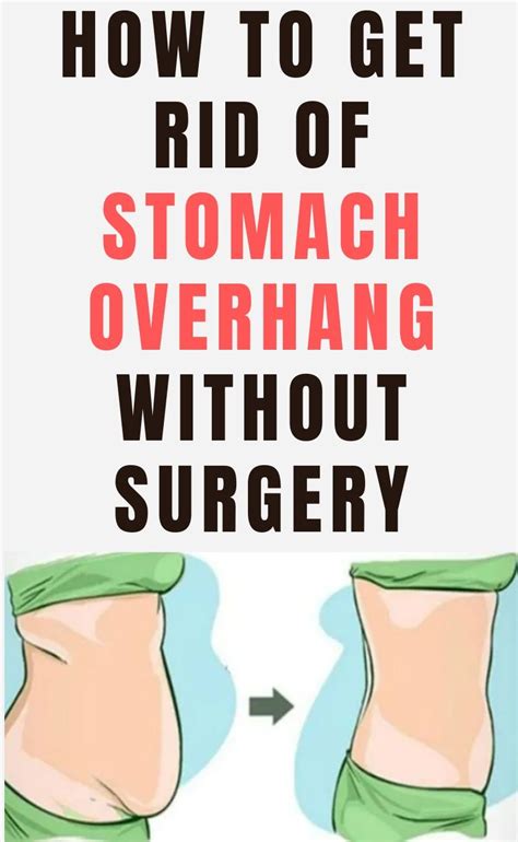 how to get rid of hanging belly fat without surgery