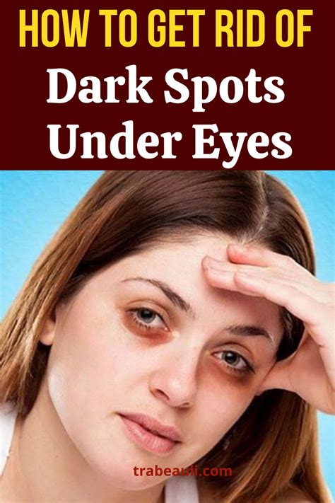 Best Treatments For Dark Circles Effective Way To Remove