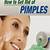 how to get rid of pimples overnight diy
