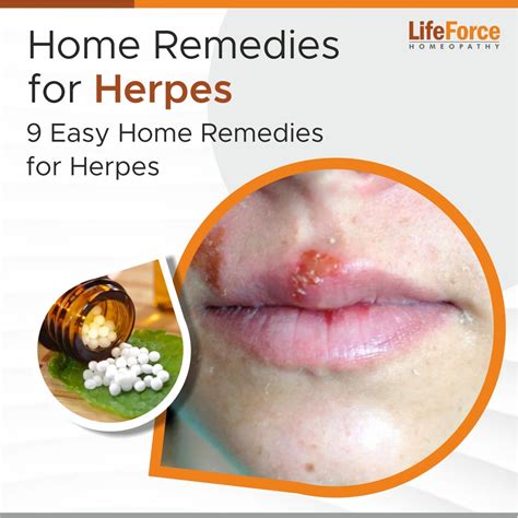 How To Stop Recurrent Herpes Outbreaks